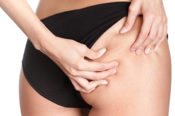 Liposuccion Relleno Graso